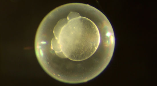 Photo of zebrafish eggs